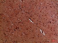 EYA1/EYA4 Polyclonal Antibody