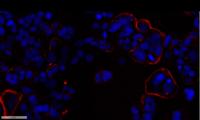 Ezrin Polyclonal Antibody