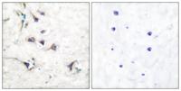 Ezrin Polyclonal Antibody