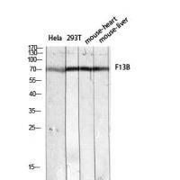 Factor XIII B Polyclonal Antibody