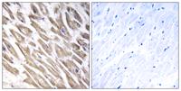 Factor XIII B Polyclonal Antibody