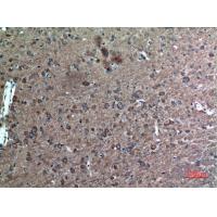FAF1 Polyclonal Antibody
