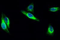 FAK Polyclonal Antibody