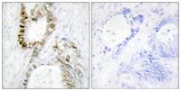 FANCA Polyclonal Antibody