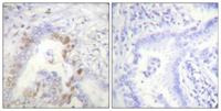 FANCD2 Polyclonal Antibody