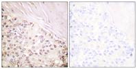 FANCD2 Polyclonal Antibody
