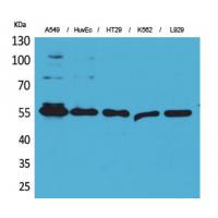 Fascin 1 Polyclonal Antibody