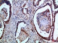 FAS-L Polyclonal Antibody
