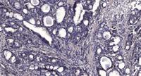 FASTKD2 Polyclonal Antibody