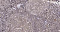 FAT1 Polyclonal Antibody