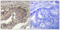 FBN1 Polyclonal Antibody