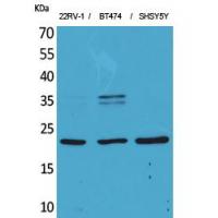 FGF-12 Polyclonal Antibody