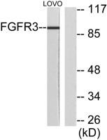 FGFR-3 Polyclonal Antibody