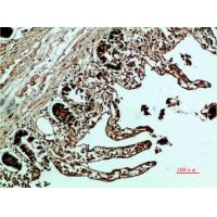Fibronectin Polyclonal Antibody