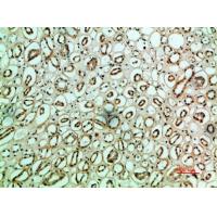 Fibronectin Polyclonal Antibody