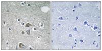 Fibulin-2 Polyclonal Antibody