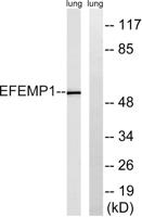 Fibulin-3 Polyclonal Antibody