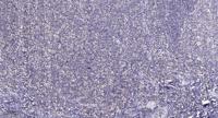 FKBPL Polyclonal Antibody