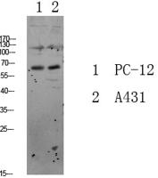 FKHRL1 Polyclonal Antibody