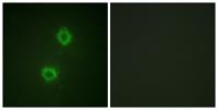 FGF Receptor 1  Polyclonal Antibody
