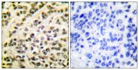 Fli-1 Polyclonal Antibody