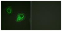 Flk-1/Flt-4 Polyclonal Antibody