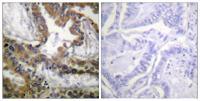 Flk-1/Flt-4 Polyclonal Antibody