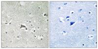 Flt-1/VEGFR1 Polyclonal Antibody
