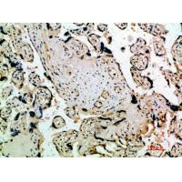 Flt-4 Polyclonal Antibody