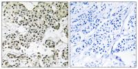 FMIP Polyclonal Antibody