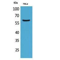 FMO3 Polyclonal Antibody
