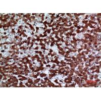 FMO3 Polyclonal Antibody