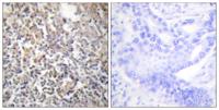 FN1 Polyclonal Antibody