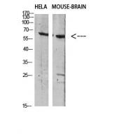 GABA T-1 Polyclonal Antibody
