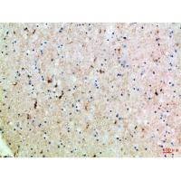 GABA T-1 Polyclonal Antibody