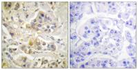 Ah Receptor Polyclonal Antibody