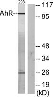 Ah Receptor Polyclonal Antibody