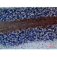 GABAA Rα1 Polyclonal Antibody