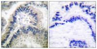 GCS-β-1 Polyclonal Antibody