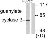 GCS-β-1 Polyclonal Antibody