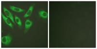 Ribosomal Protein S6 Polyclonal Antibody