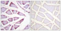 Ribosomal Protein S6 Polyclonal Antibody