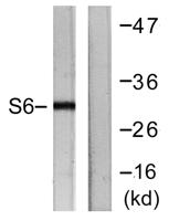 Ribosomal Protein S6 Polyclonal Antibody