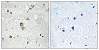 Ribosomal Protein S9 Polyclonal Antibody