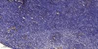 Follistatin Polyclonal Antibody
