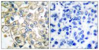 FOP Polyclonal Antibody