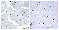 Formin 2 Polyclonal Antibody