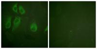 IL-2Rα Polyclonal Antibody