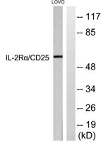 IL-2Rα Polyclonal Antibody