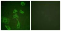 IL-2Rβ Polyclonal Antibody